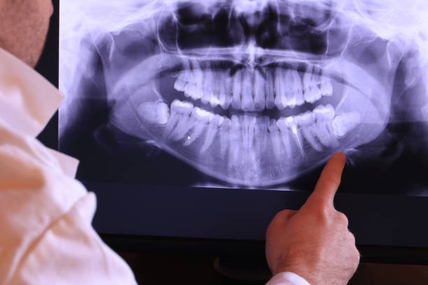 Best Emergency Root Canal Treatment in Jackson, SC