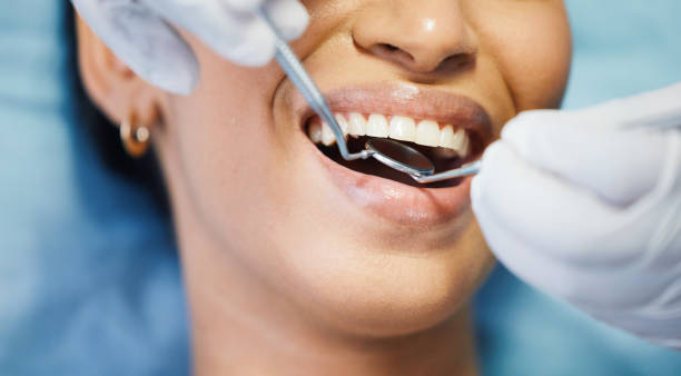Best Emergency Tooth Extraction in Jackson, SC