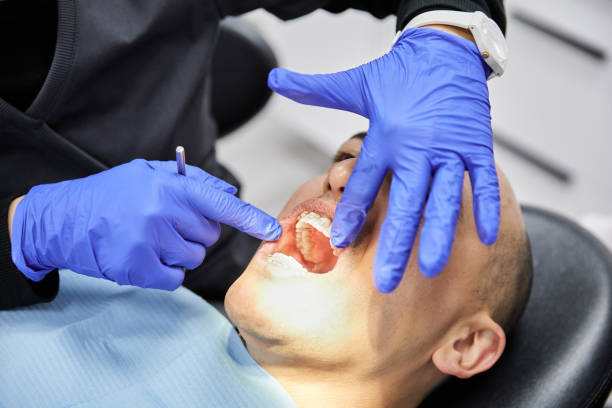 Best Emergency Treatment for Dental Infections or Abscesses in Jackson, SC